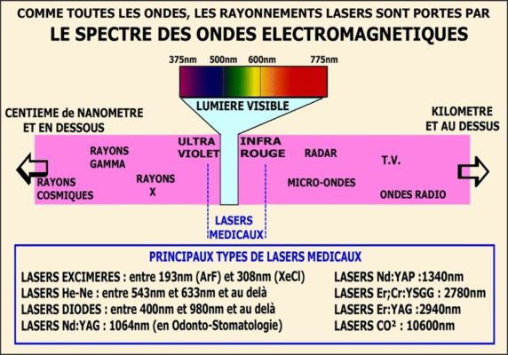 3 572x400 - Mode de fonctionnement des lasers